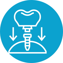 implante-dental (1)