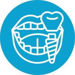 implante-dental (2)