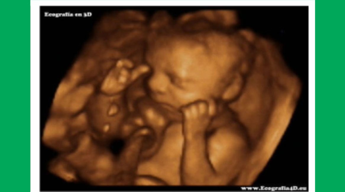 DR. ÁLVARO E. LEÓN LARA - GINECOLOGÍA Y OBSTETRICIA