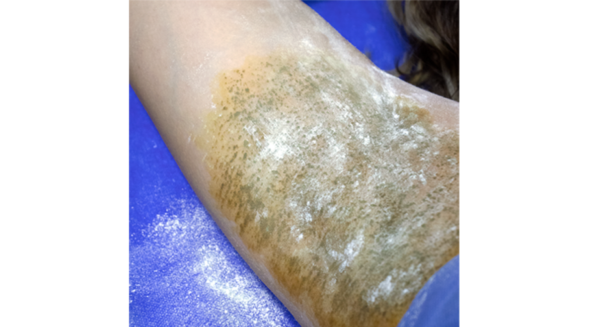 Dermatologa Monica Hernandez Bulla