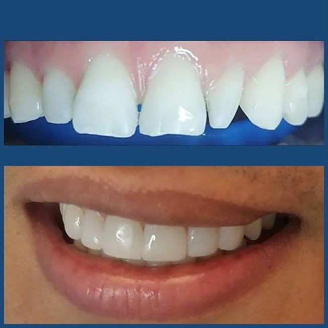 SONREIR ODONTOLOGIA ESTÉTICA