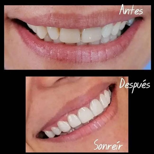 SONREIR ODONTOLOGIA ESTÉTICA