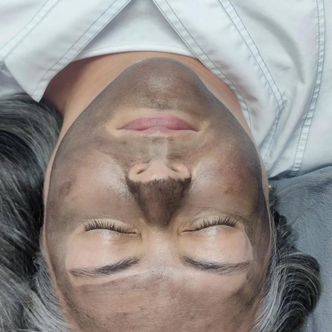 Body Láser