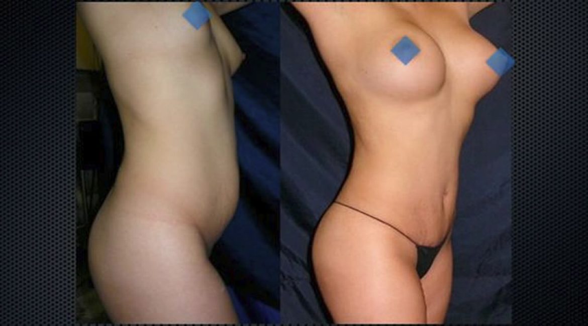DR. MARTIN A. GONZALEZ / CIRUJANO PLASTICO