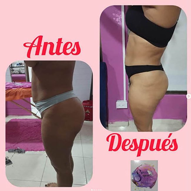 Esthetic Body Spa