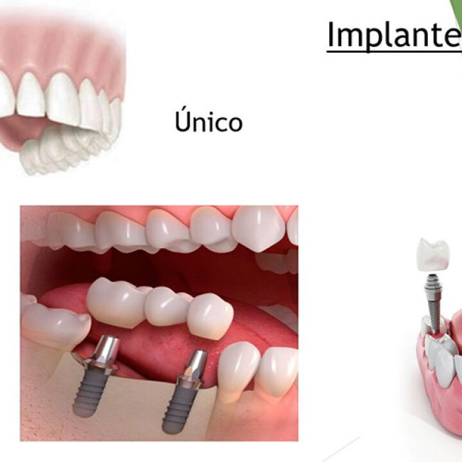 Dr. Enrique Parra Tabares - Arte Dental