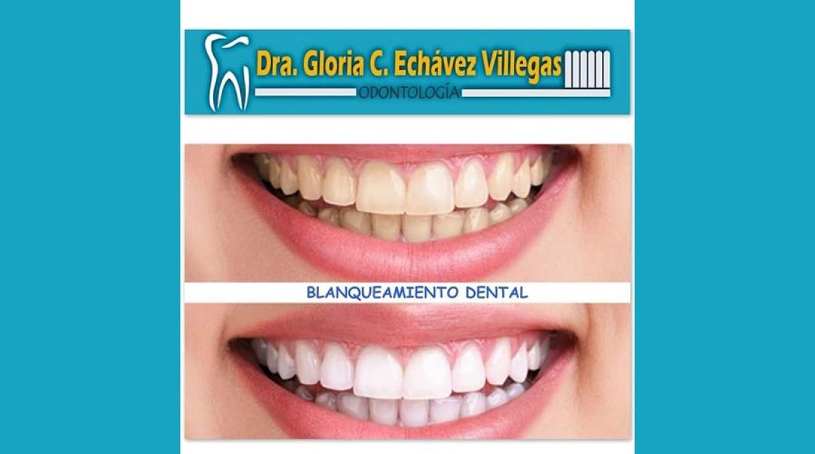 Dra. Gloria Echavez Villegas Odontolgía