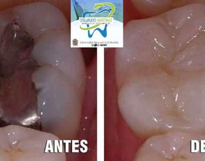 CONSULTORIO ODONTOLÓGICO Dr. OSWALDO MARTÍNEZ