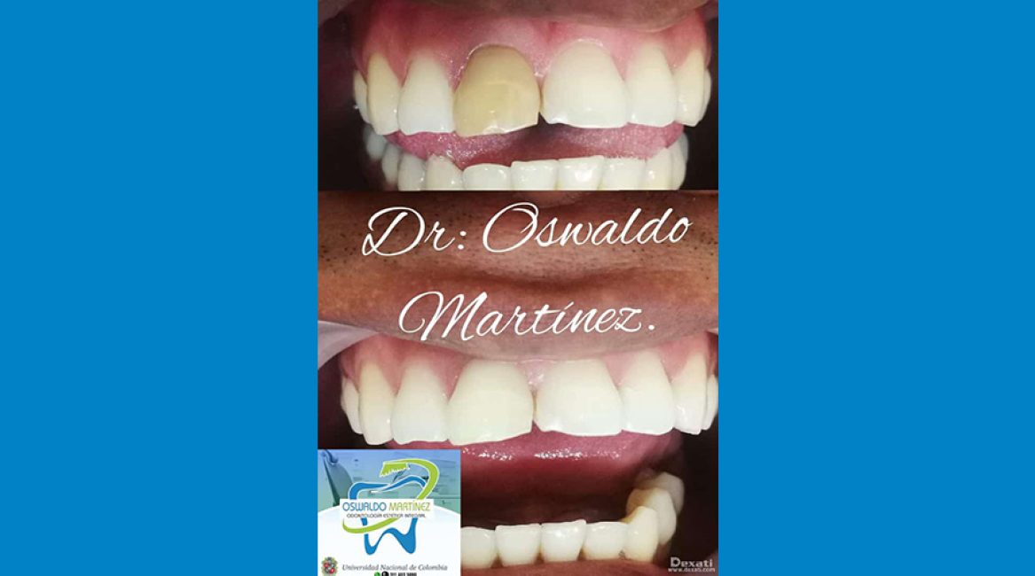 CONSULTORIO ODONTOLÓGICO Dr. OSWALDO MARTÍNEZ