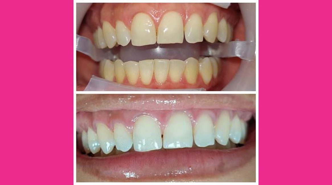 AmaSmile