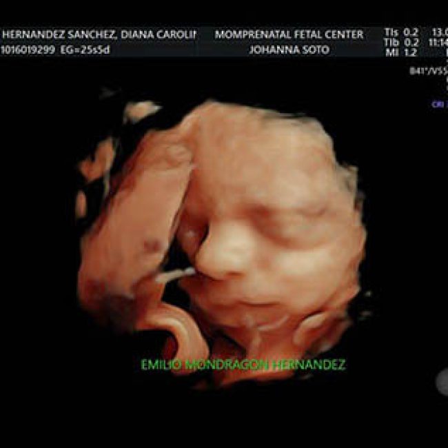 Dra Carolina Hernández Ginecología & Obstetricia