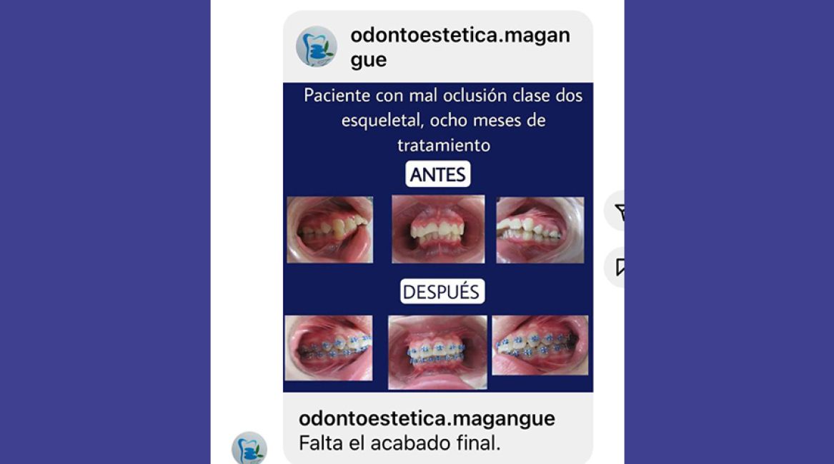 Odontoestética - Doctor Gustavo Arrieta Hernández