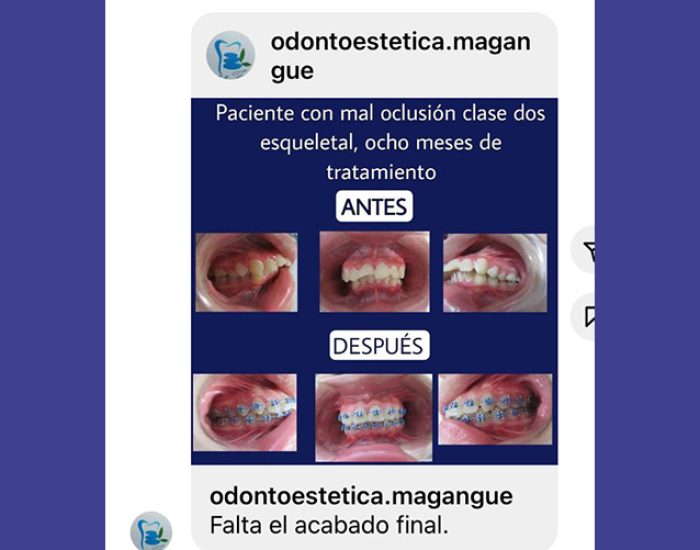 Odontoestética - Doctor Gustavo Arrieta Hernández